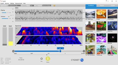Cygnet® Software